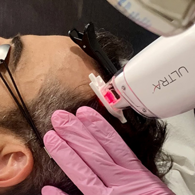 LaseMD Skin Resurfacing