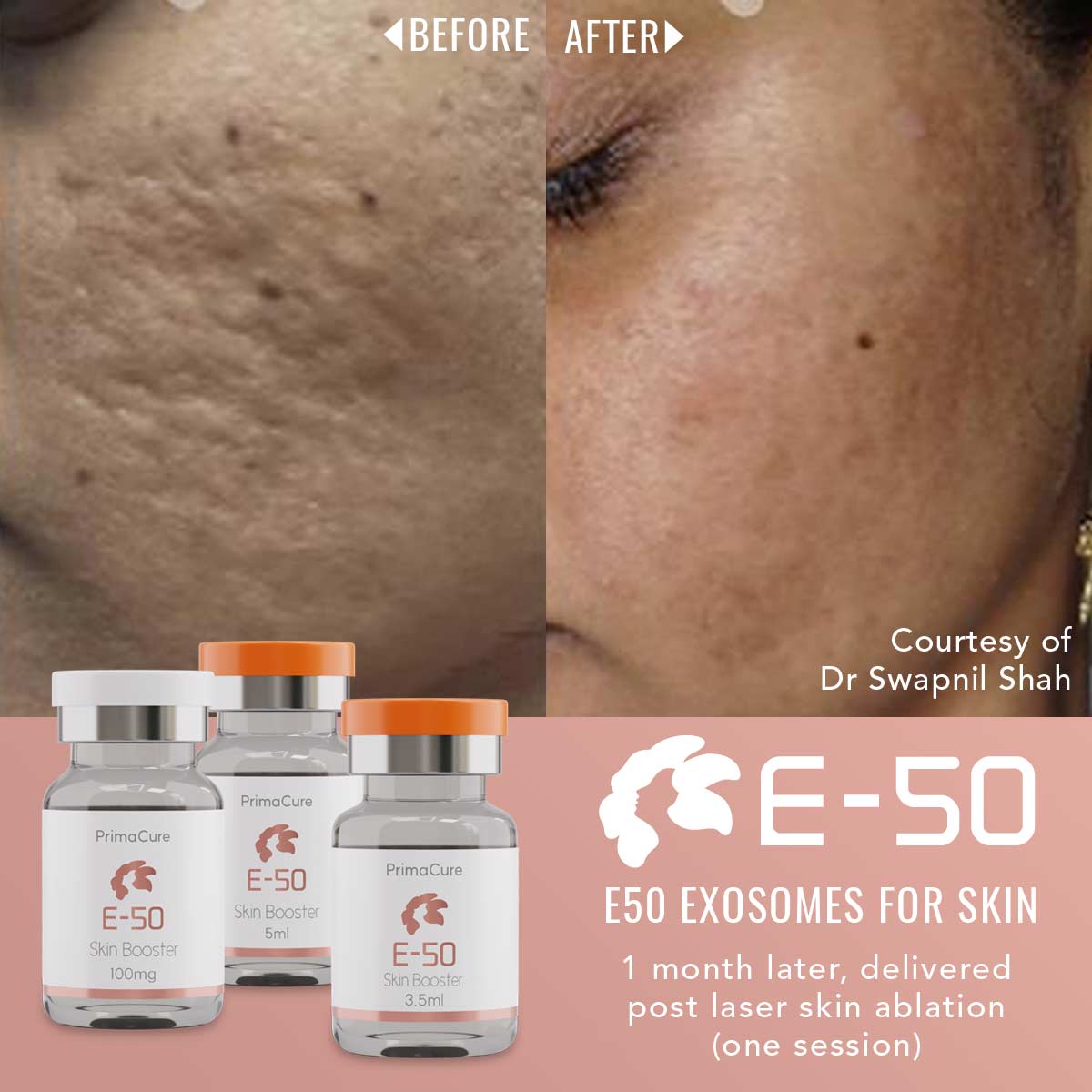 Exosome Skin Rejuvenation