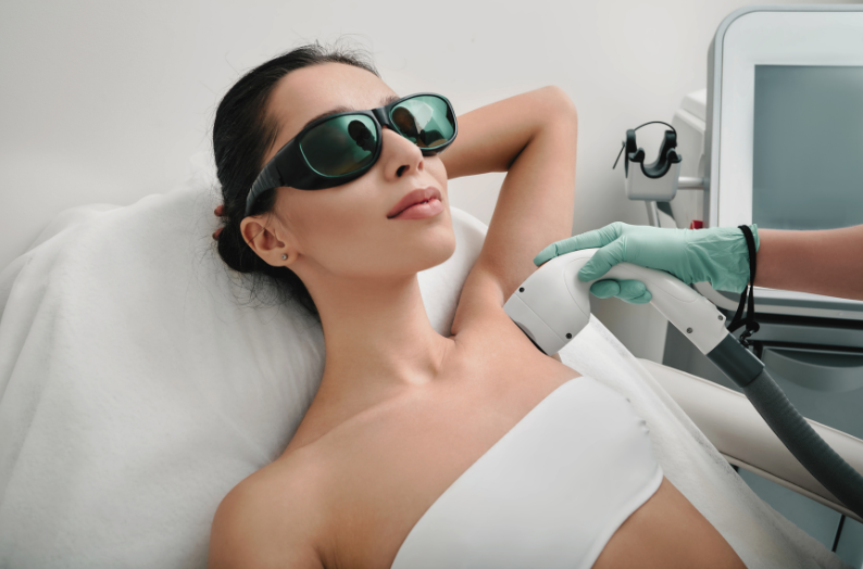 10 Expert Tips to Maximise Your Laser Hair Removal Results