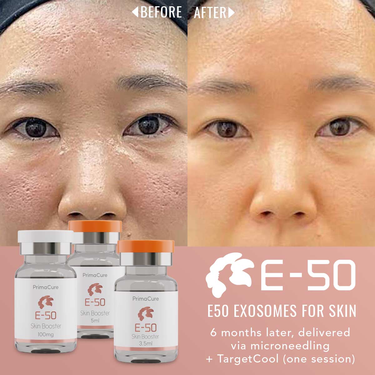 Exosome Skin Rejuvenation