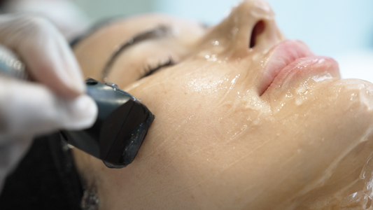 Forma Radiofrequency Skin Tightening