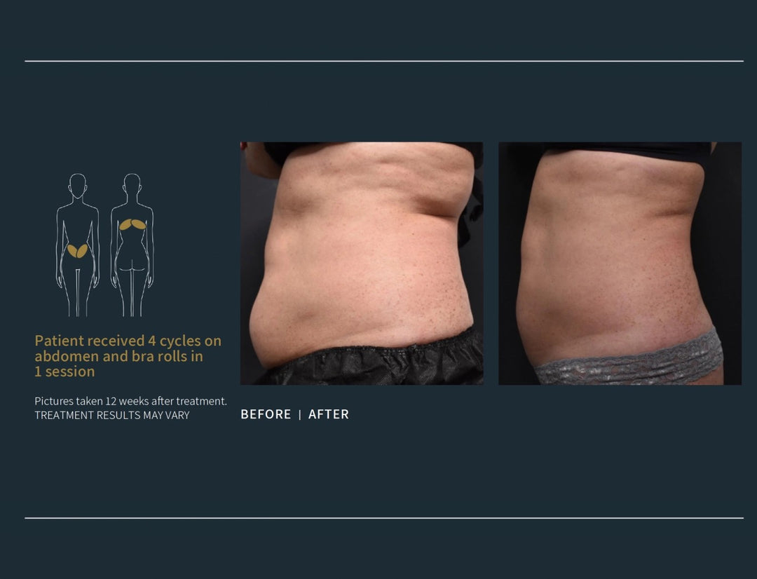 Body Contouring Specialists