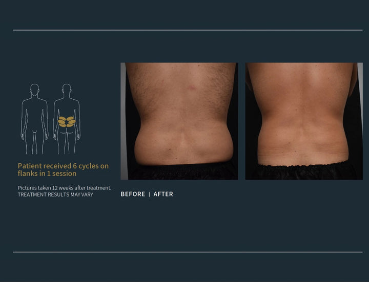 Body Contouring Specialists